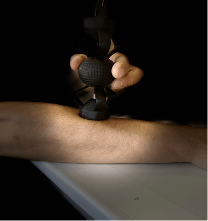 SKID – Skin care detector - 1R6saRYKNaz8a.png